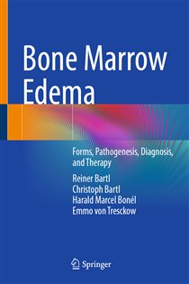 Bone Marrow Edema Forms, Pathogenesis, Diagnosis, and Therapy