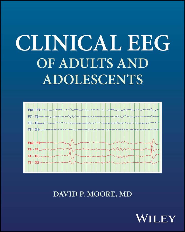 Clinical EEG of Adults and Adolescents
