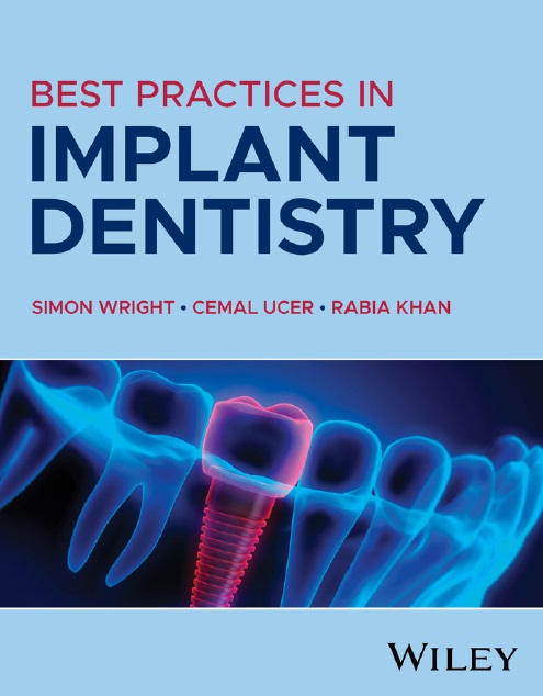 Best Practices in Implant Dentistry