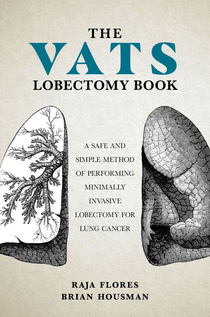 The VATS Lobectomy Book: A Safe and Simple Method of Performing Minimally Invasive Lobectomy for Lung Cancer