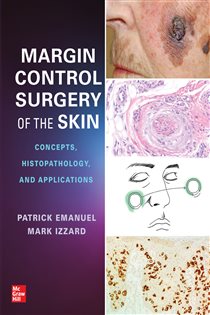 Margin Control Surgery of the Skin: Concepts, Histopathology, and Applications